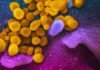 World experts and funders set priorities for COVID-19 research