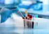 Thyrocare slashes COVID-19 test prices Thyrocare