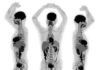 Explorer – Total-body imaging scanner captures 3D picture in seconds Explorer