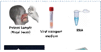 CSIR & Reliance Industries to develop RT-LAMP based test for Covid-19 CSIR