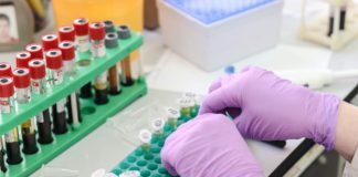 Sinovac proceeds for phase 3 trials of Covid-19 vaccine vaccine