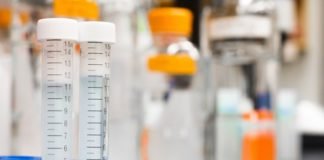 ICMR-NIV develops IgG ELISA test for antibody detection IgG ELISA