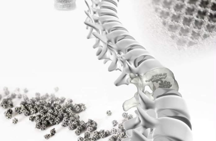GEADPR039b MT Ortho