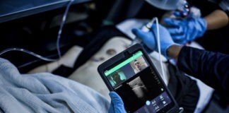 Philips expands remote clinical collaboration offering based on the Reacts platform Philips