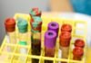 Sanofi and Regeneron provide update on Kevzara Phase 3 Covid-19 trials Sanofi