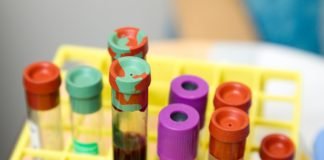 Sanofi and Regeneron provide update on Kevzara Phase 3 Covid-19 trials Sanofi
