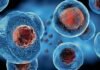 Cipla & Stempeutics collaborate for launch of Stempeucel cell therapy