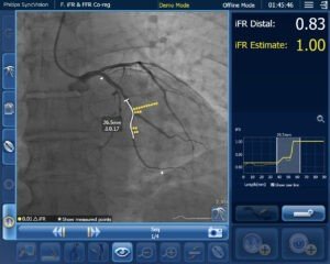 Define PCI