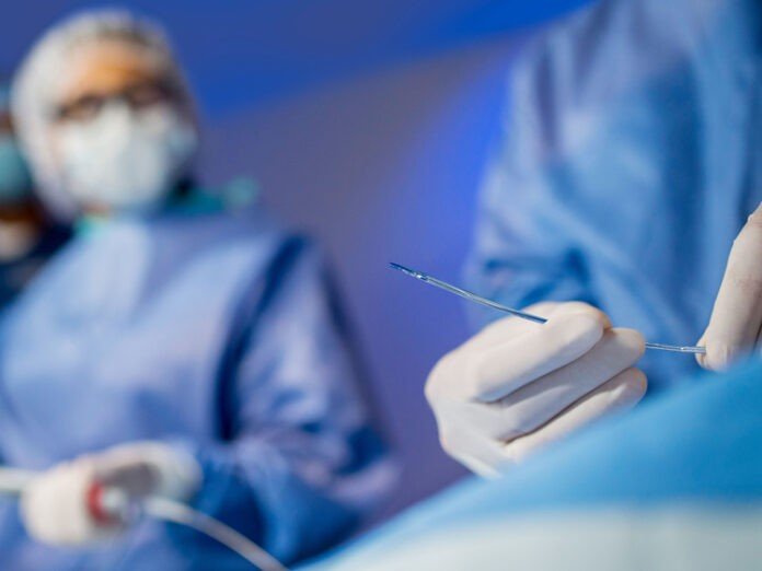 Philips Stellarex low dose drug coated balloons shows good results in 5-year study Photo Philips Healthcare