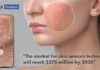Selfies as Skin Saviors Cell phone cameras for skincare