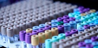 Cipla, Dr. Reddy’s, Emcure, Sun Pharma & Torrent to collaborate for Molnupiravir clinical trial trial for mild Covid-19 drug