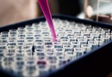 CanStaging+ software developed by Queen’s to capture worldwide cancer data launched CanStaging+