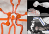 Joystick-Operated robot to help surgeons treat stroke remotely