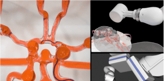 Joystick-Operated robot to help surgeons treat stroke remotely