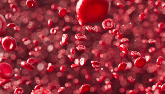 image (33) Thalassemia