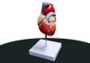 40-year-old with ruptured aorta saved aorta