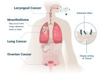 Queen Mary University London develops a new ‘wonder’ drug for cancer drug