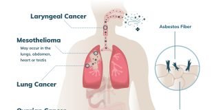 Queen Mary University London develops a new ‘wonder’ drug for cancer drug