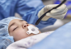 New Philips Mini TEE ultrasound transducer Philips