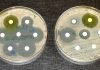 FSSAI unveils action plan on anti-microbial resistance FSSAI