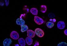 India faces steep blood cancer mortality rates with over 70,000 annual deaths cancer