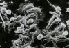 FDA approves first gene therapy for Metastatic Synovial Sarcoma FDA approves first gene therapy for Metastatic Synovial Sarcoma