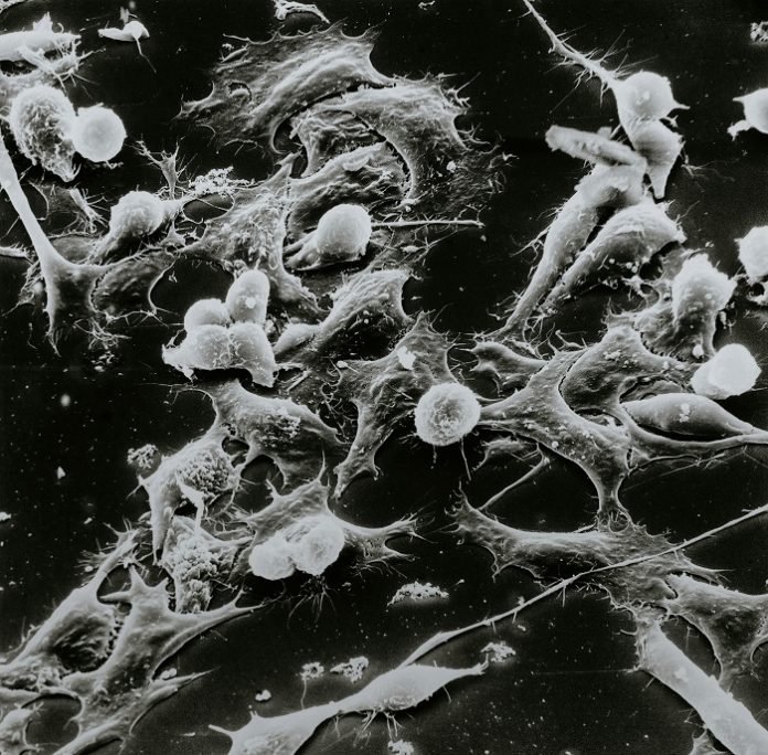 national-cancer-institute-wUg8xhJ3aBs-unsplash FDA approves first gene therapy for Metastatic Synovial Sarcoma