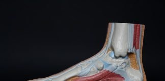 FDA go-ahead to Sun Pharma to develop osteoarthritis knee pain drug Sun Pharma and Israel-based Moebius Medical have announced that the US Food and Drug Administration (FDA) has granted fast-frack designation (FTD) to MM-II (large liposomes of DPPC and DMPC) for the treatment of osteoarthritis knee pain.