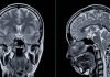 Book review: The Pitfalls of Unquestioned Alzheimer’s Research Alzheimer’s