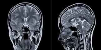 Book review: The Pitfalls of Unquestioned Alzheimer’s Research Alzheimer’s