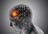 Younger strokes are rising in India India