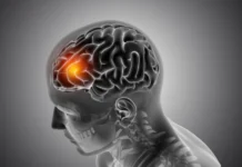 Younger strokes are rising in India India