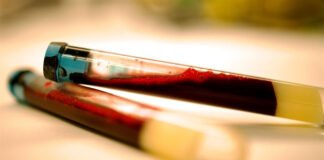 Early signs of Parkinson’s can be identified in the blood Parkinson’s