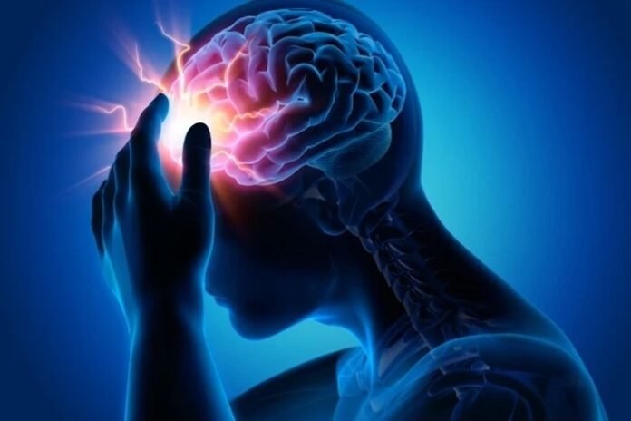 Epilepsy