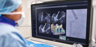 FDA clears Philips AI solution Philips