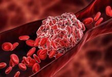 Rare hidden blood disorder treated blood