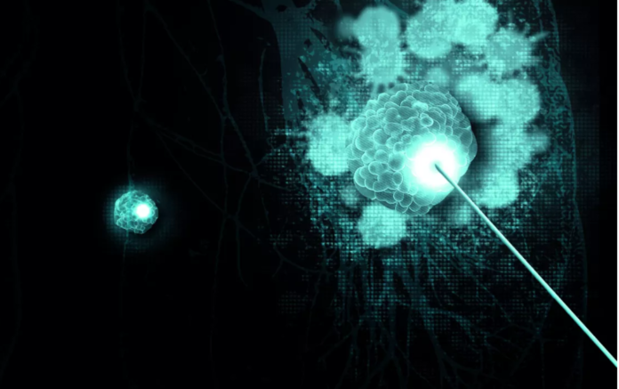immu Immunotherapy treatments have revolutionized cancer management over the last decade. Th