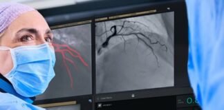 Philips introduces SmartIQ to address the trade-off between image quality and radiation dose in coronary procedures Philips