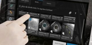 Philips at EuroPCR 2026 Philips