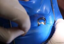 Kraiburg TPE’s medical-grade TPE solutions for advanced dental applications Kraiburg