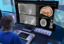 Philips selected for ARPA-H program Philips